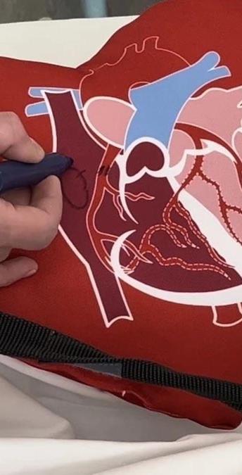 Медики кардиоцентра в Хабаровске внедрили собственную методику реабилитации