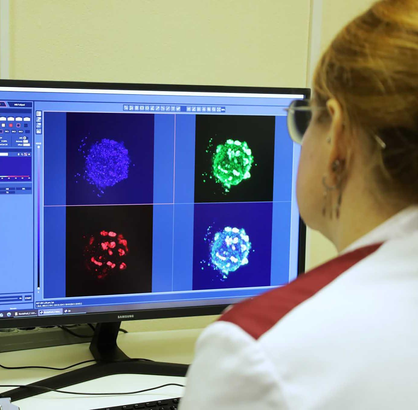 В&nbsp;Томске создали модель для&nbsp;тестирования препаратов против метастазов