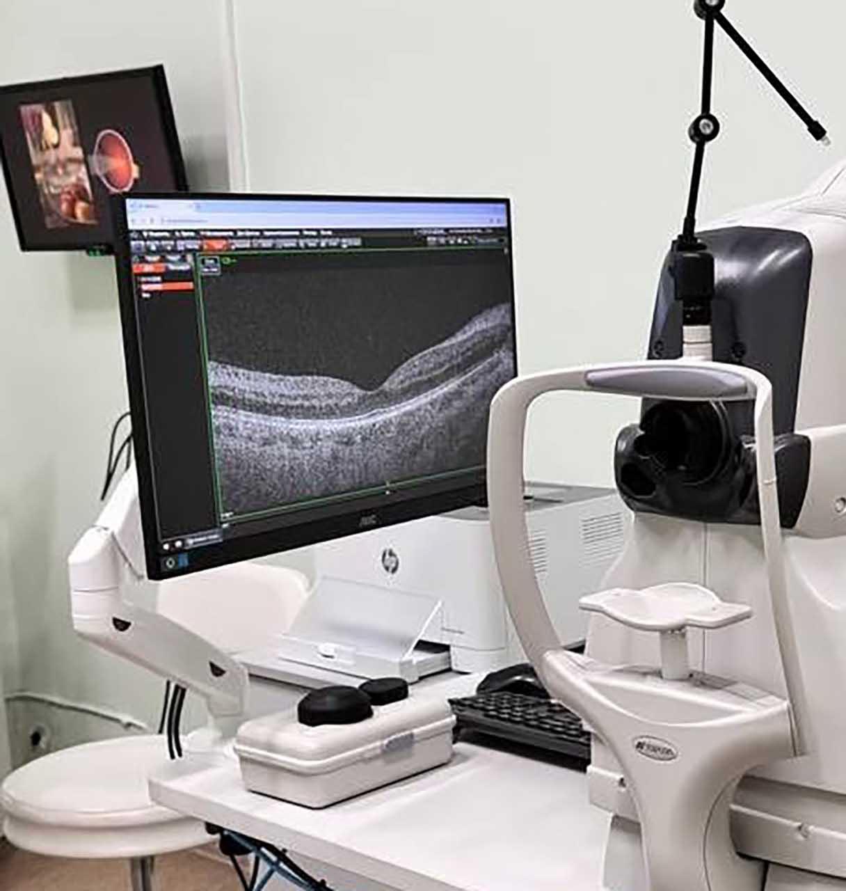 В&nbsp;больнице Костромы установили томограф для&nbsp;выявления поражения сетчатки