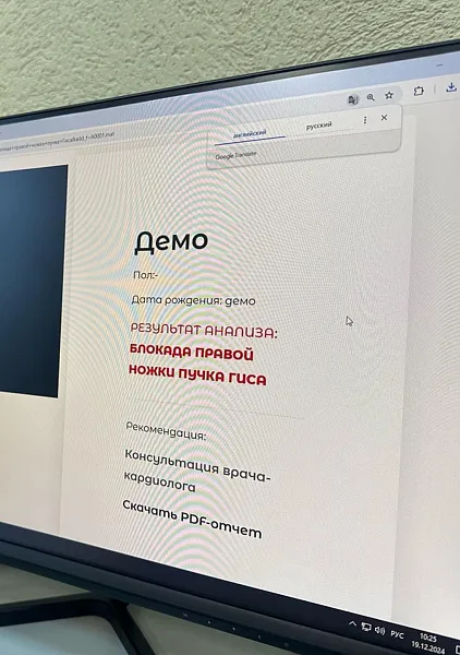 В&nbsp;Пензе создали приложение для&nbsp;анализа результатов кардиограмм